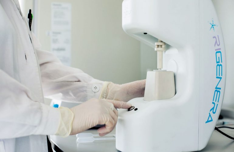 imagen de tratamiento regenera activa alopecia clinica renacimiento madrid
